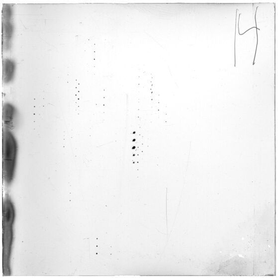 Scan ESP1532
