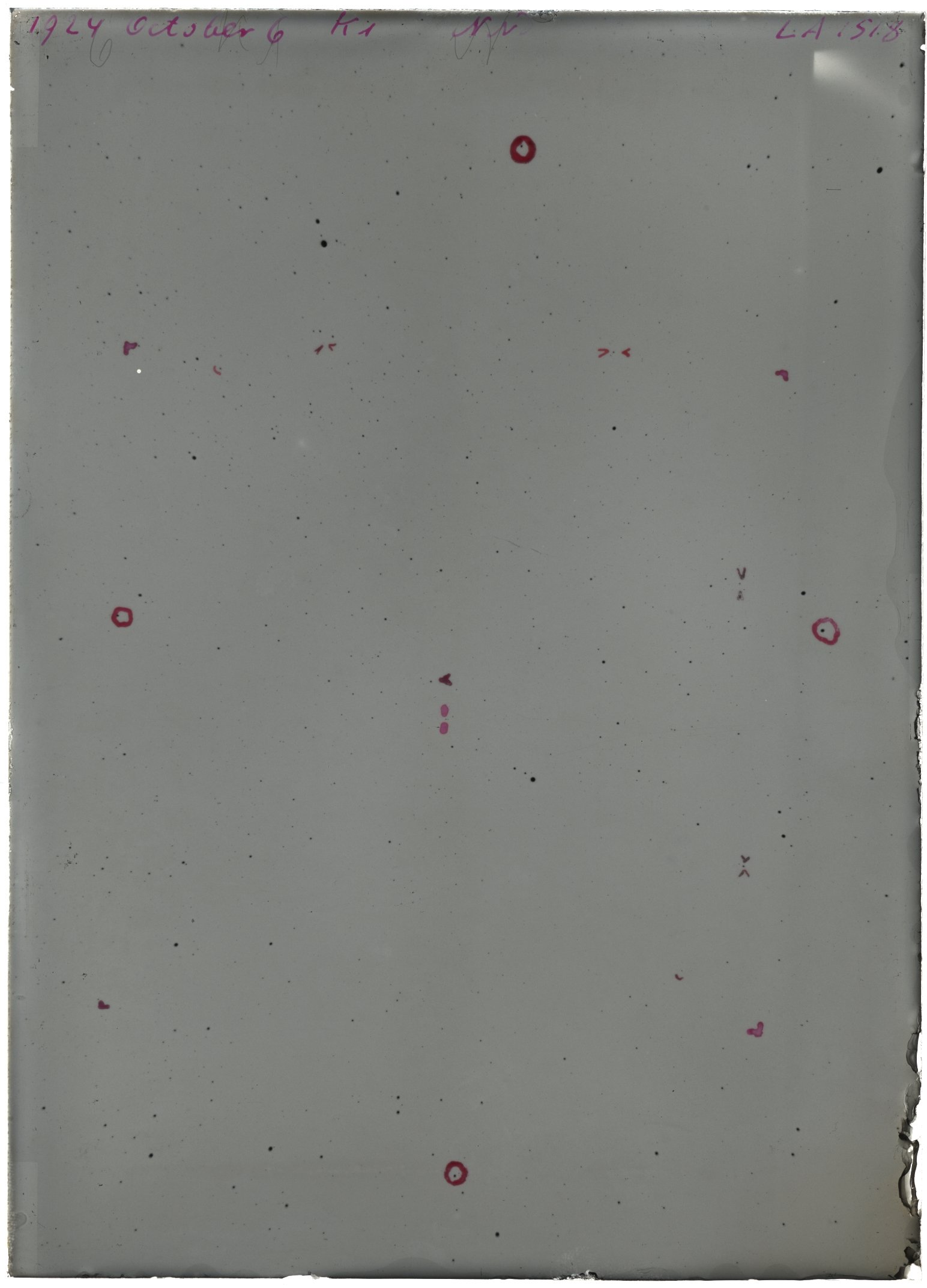 Scan LA01518