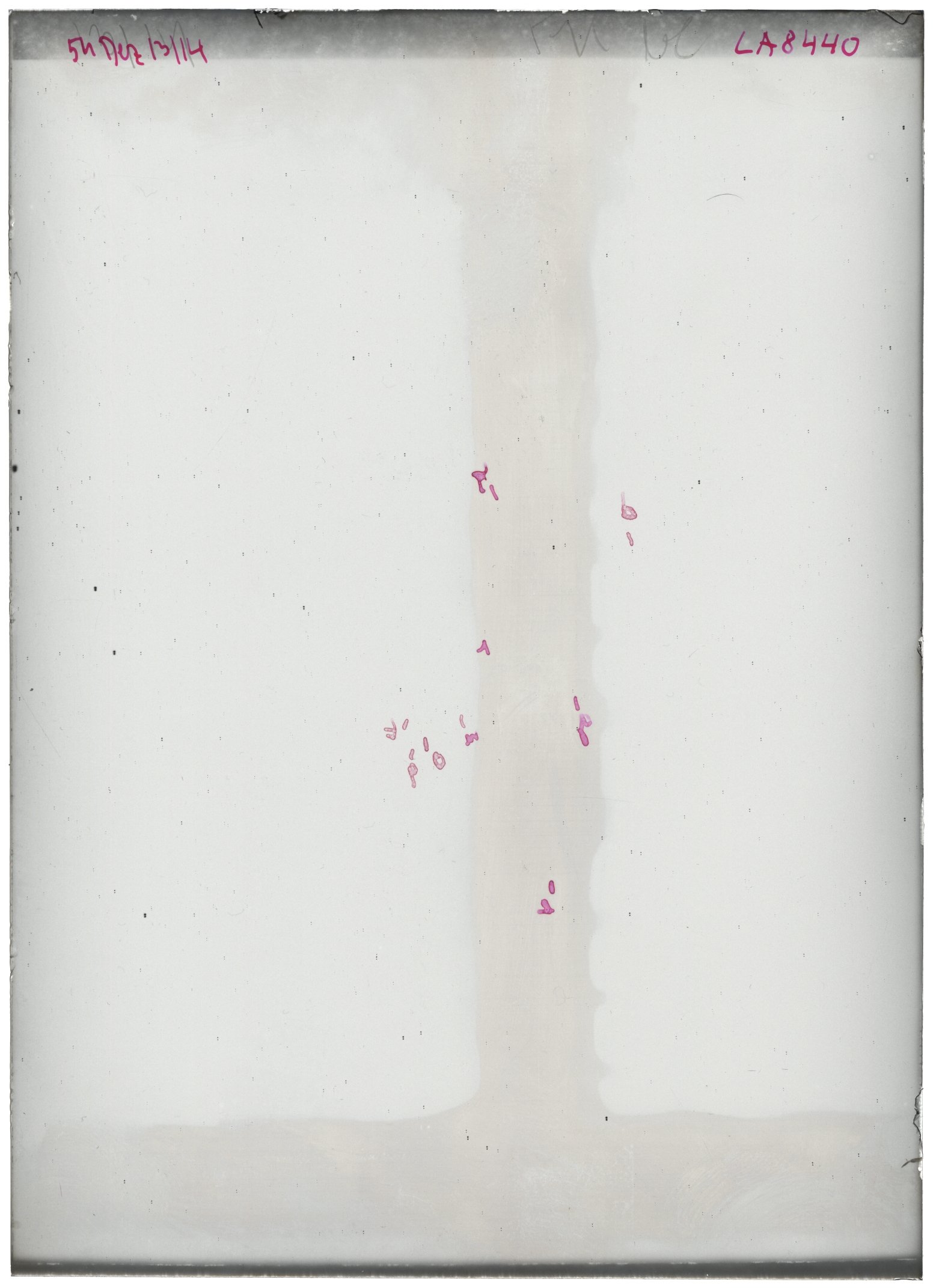 Scan LA08440