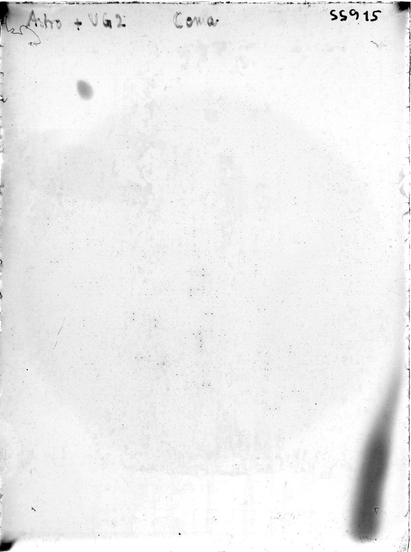 Scan SS00915
