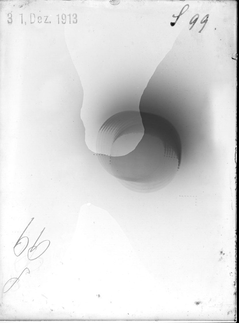 Scan ST00099