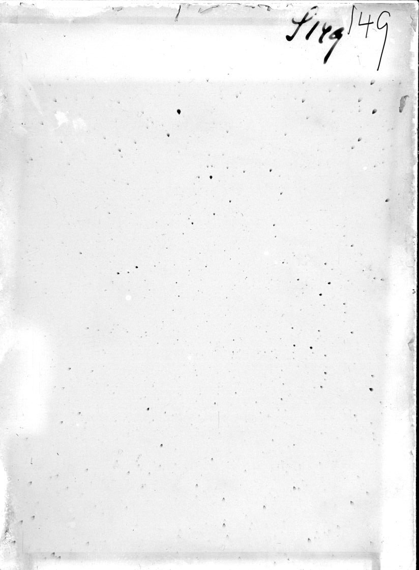 Scan ST00149