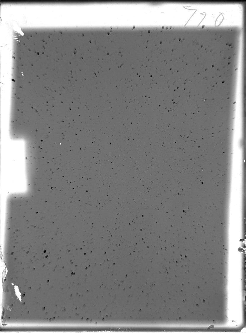 Scan ST00720