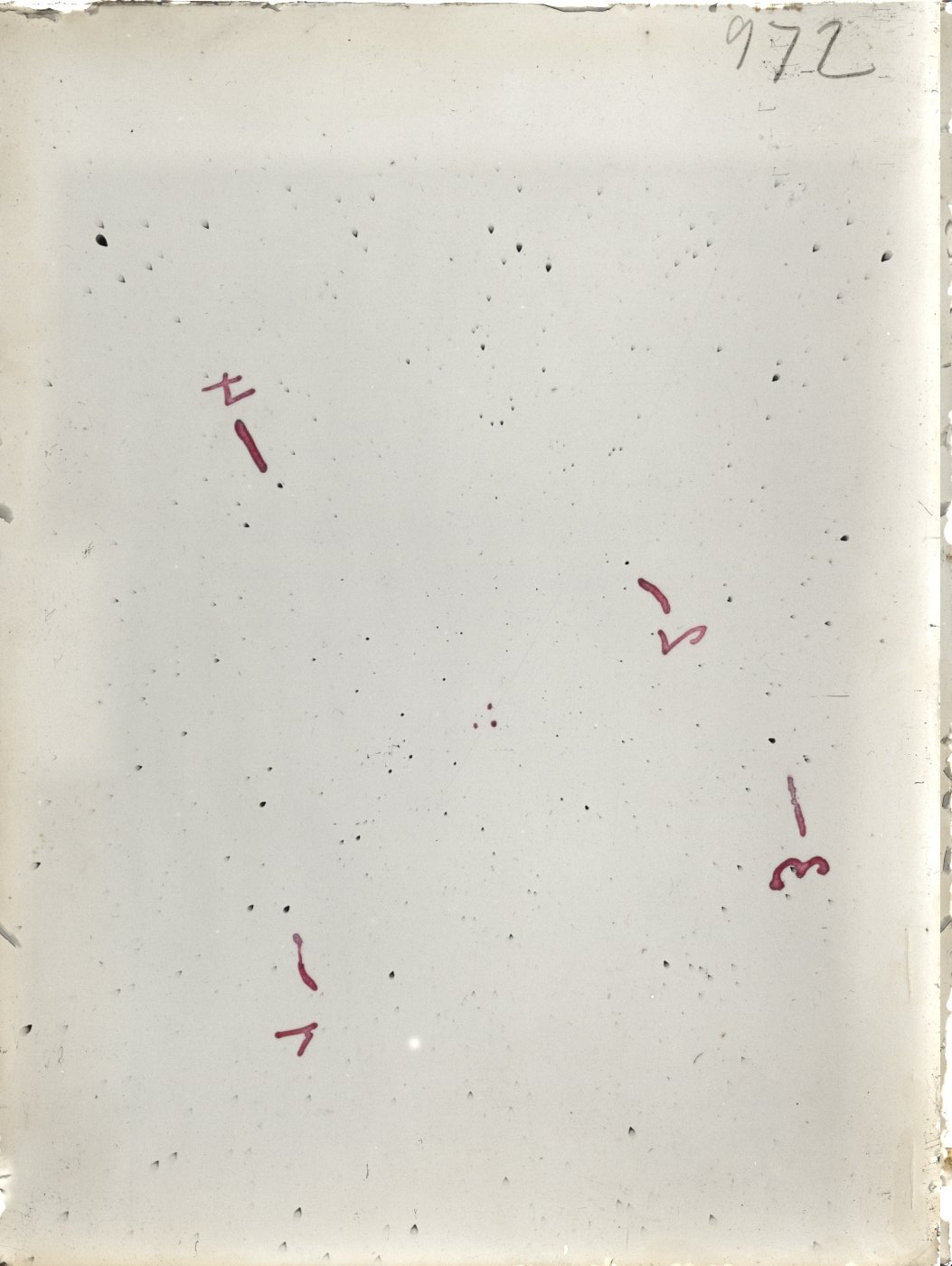 Scan ST00972