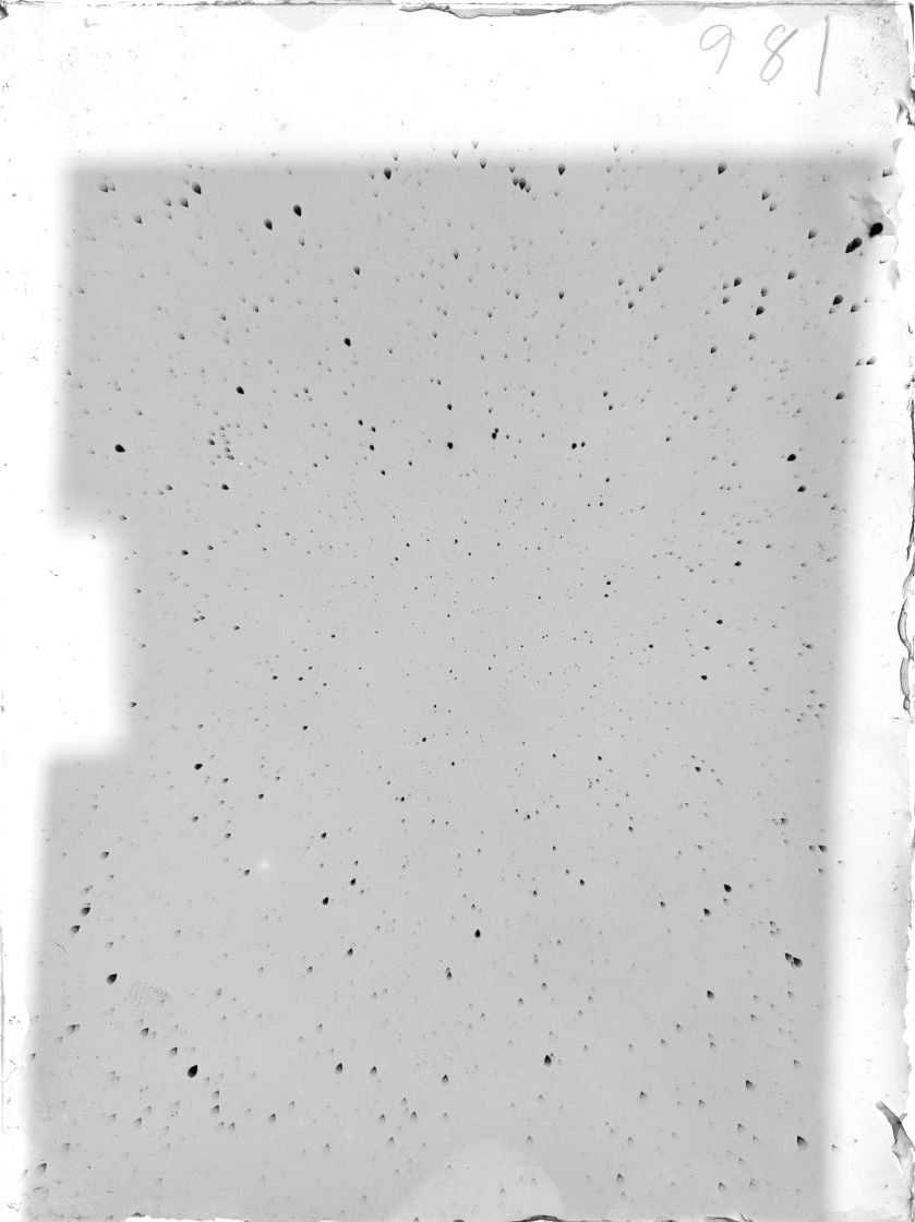 Scan ST00981