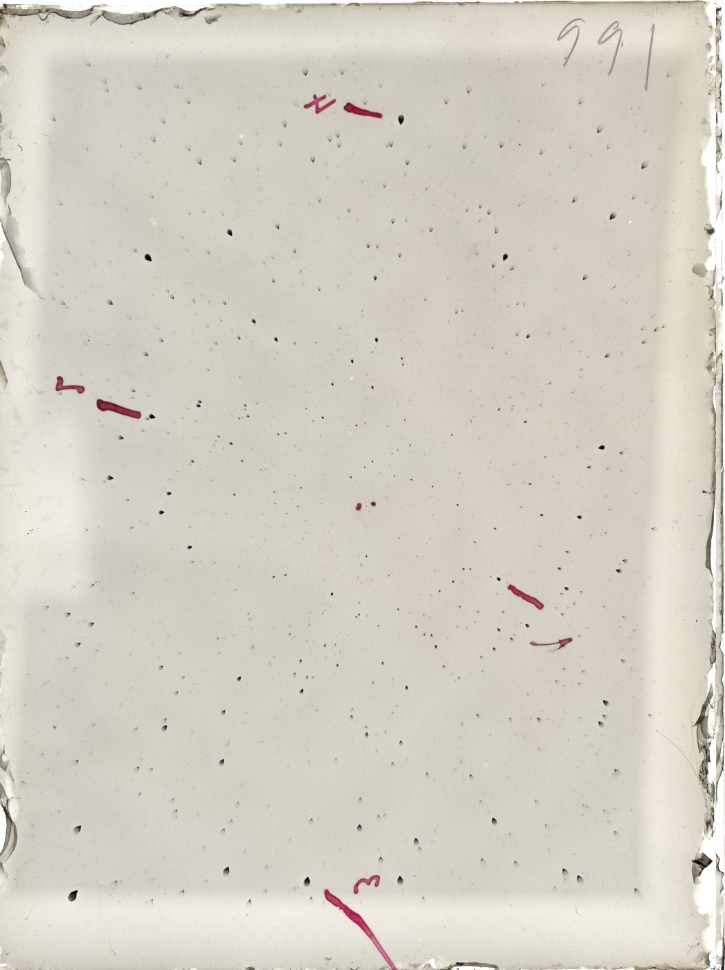 Scan ST00991