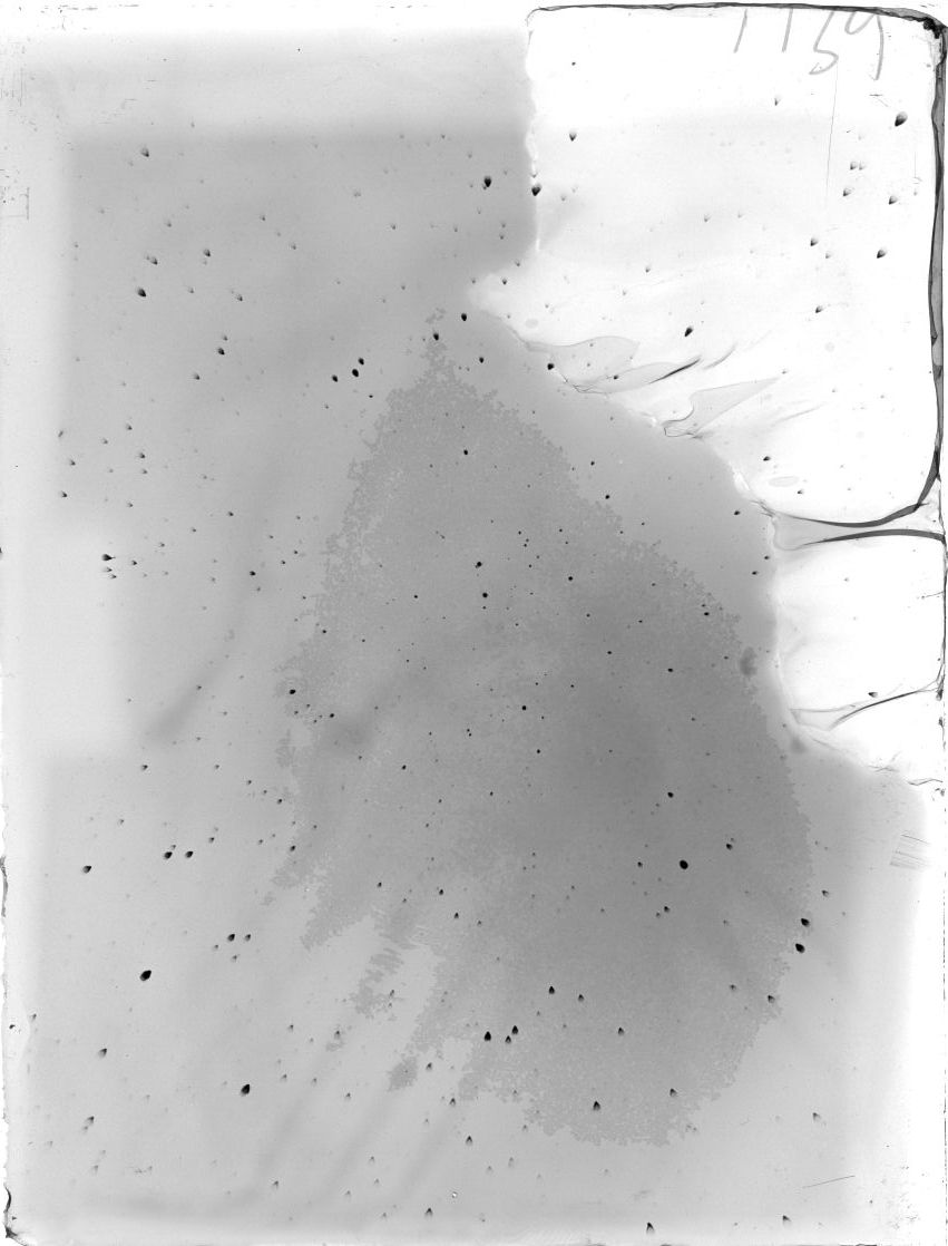 Scan ST01139