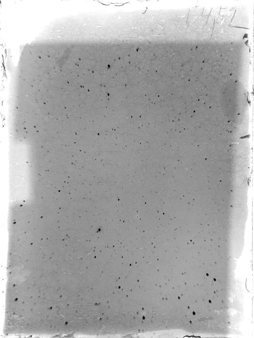 Scan ST01452