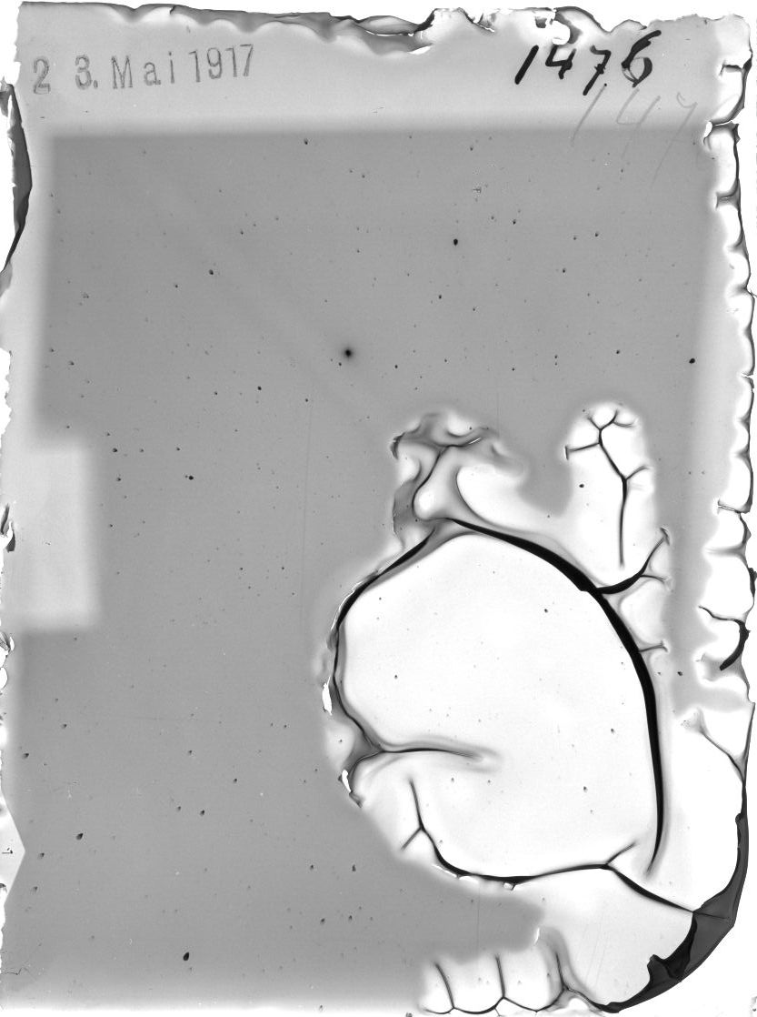 Scan ST01476