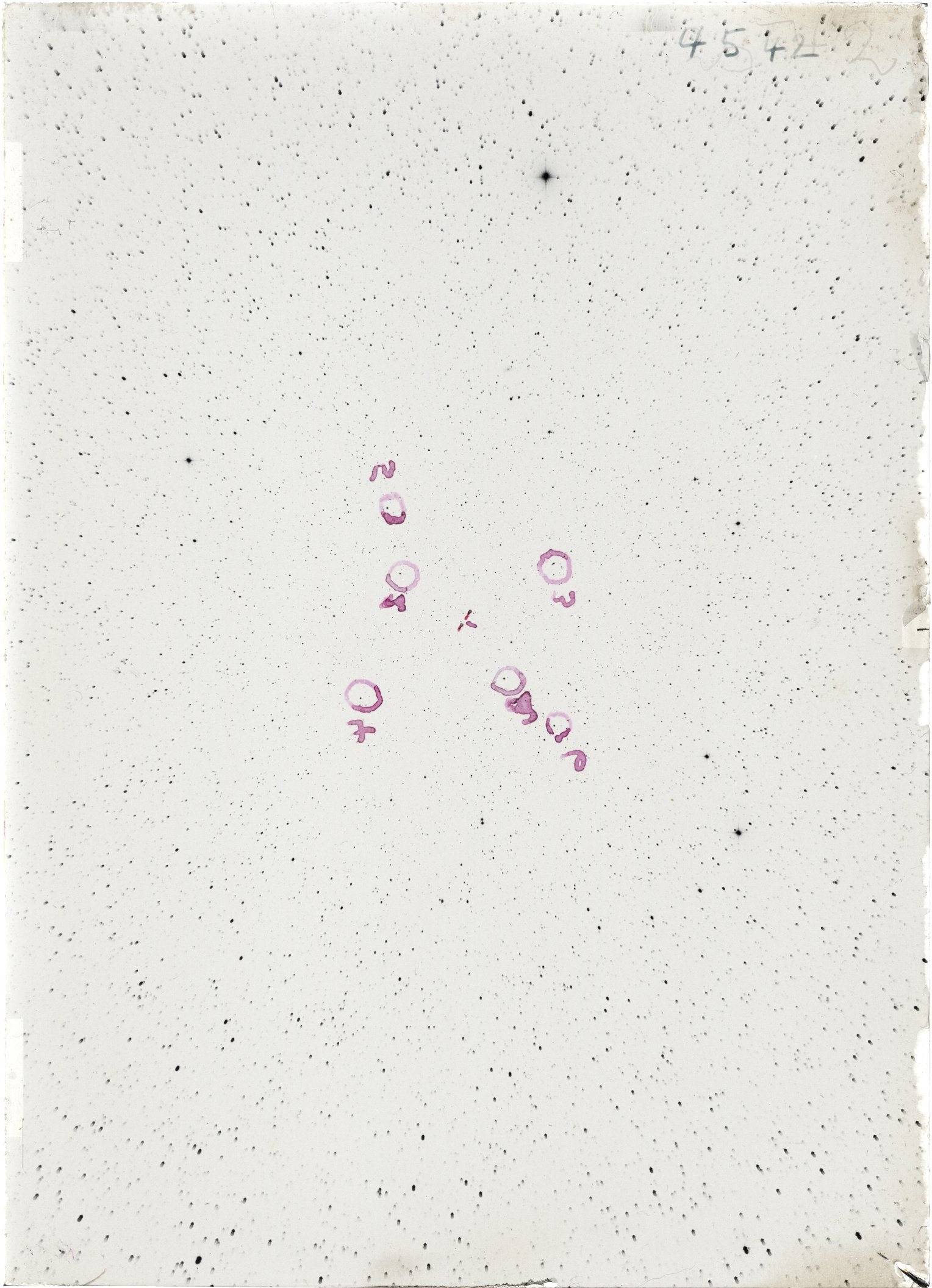 Scan ST04542