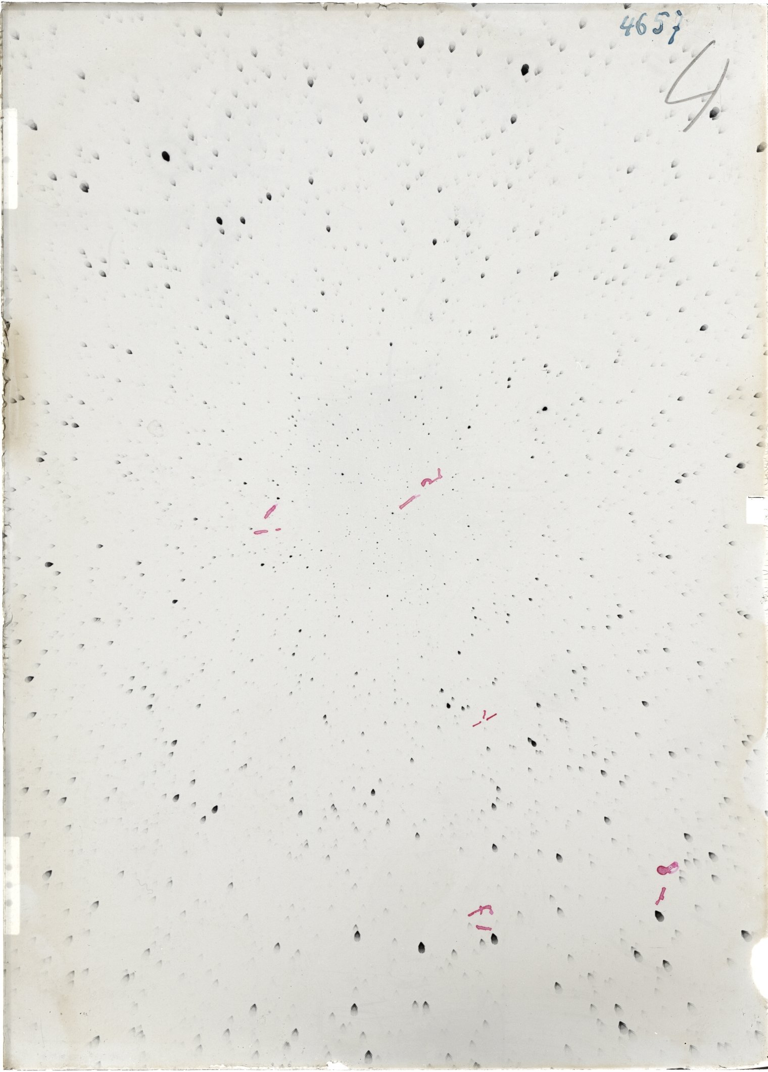 Scan ST04657