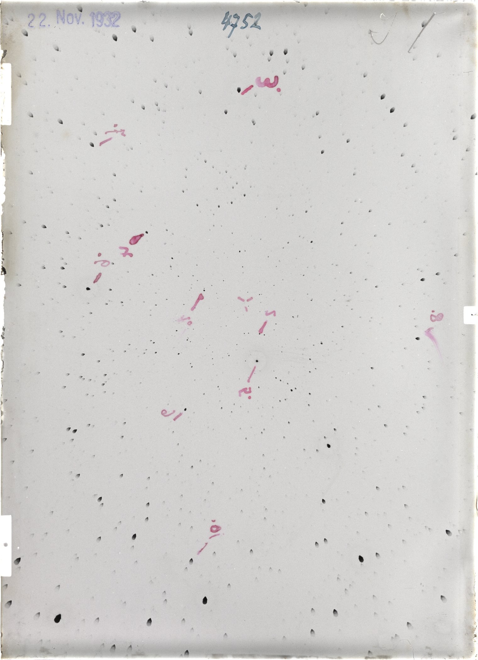 Scan ST04752