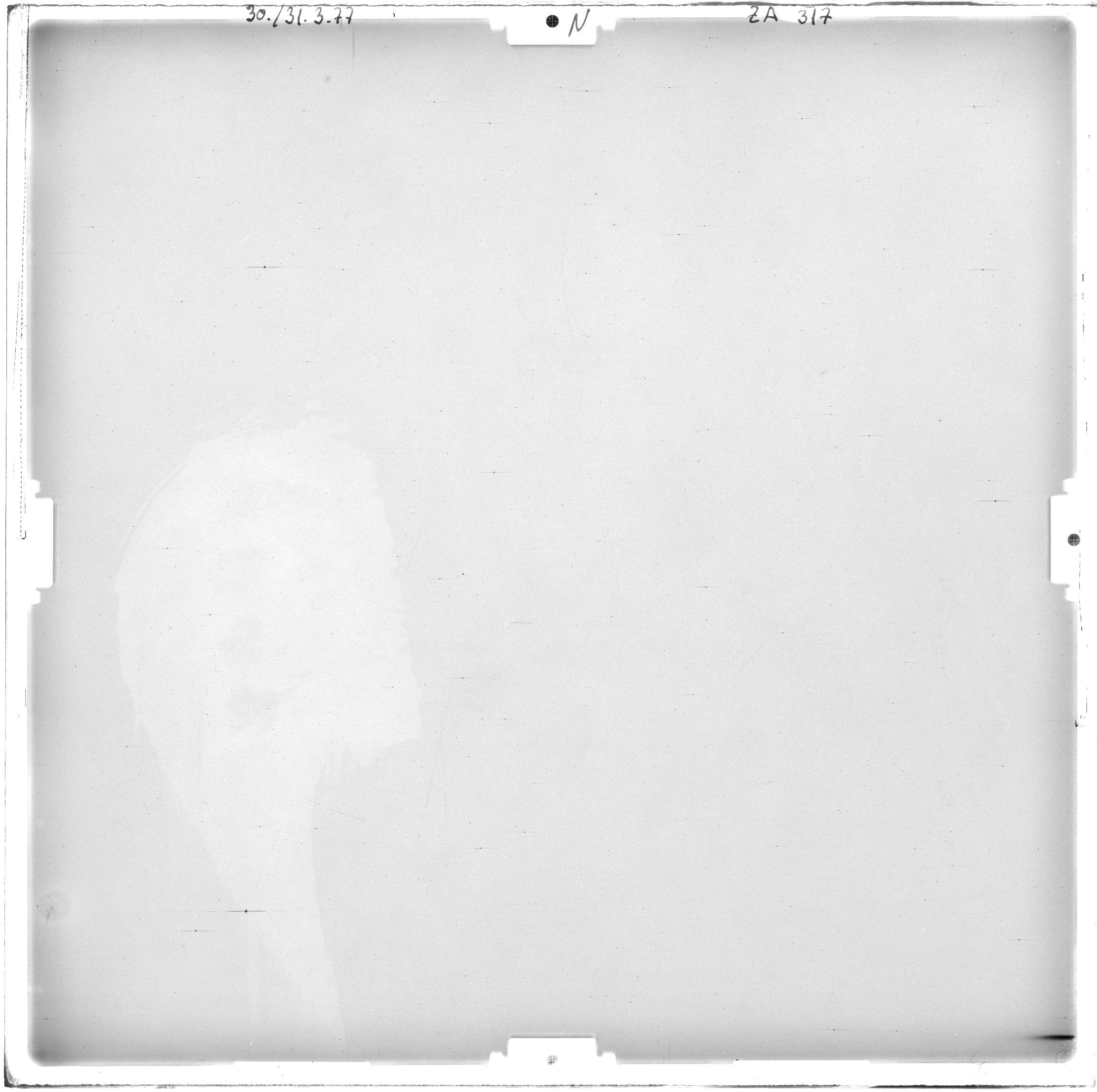Scan ZA00317