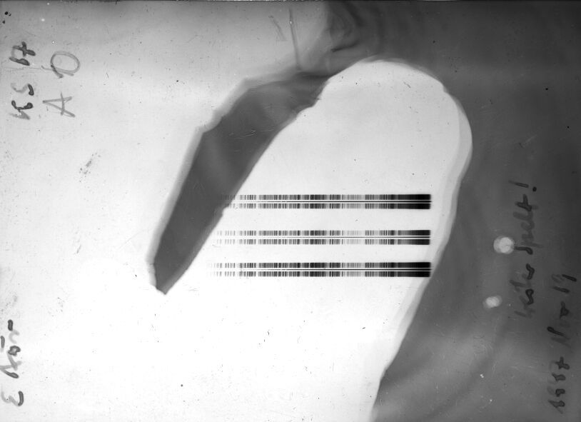 Scan STK0017