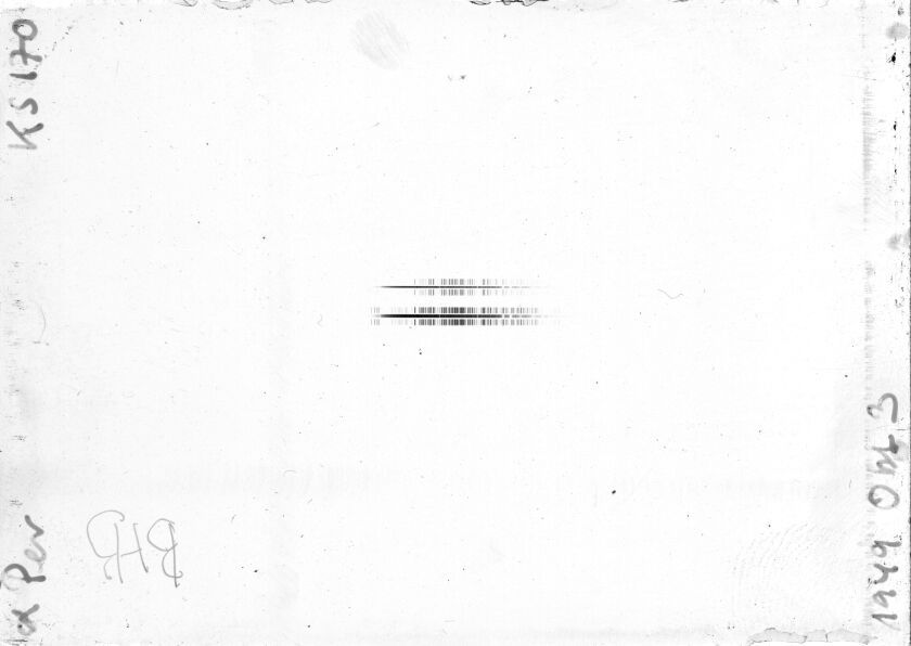 Scan STK0170