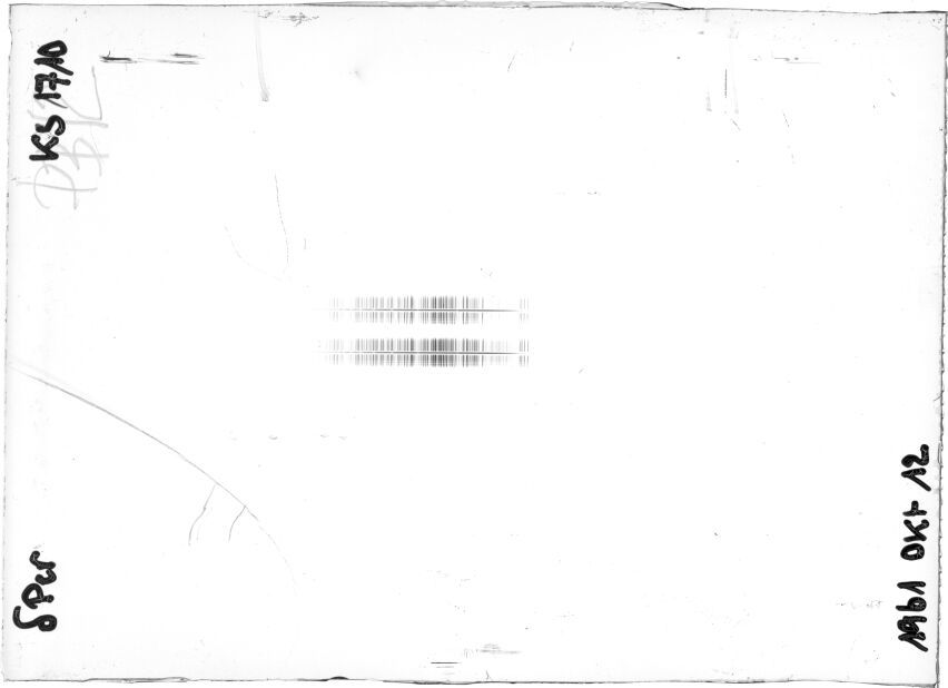Scan STK1710