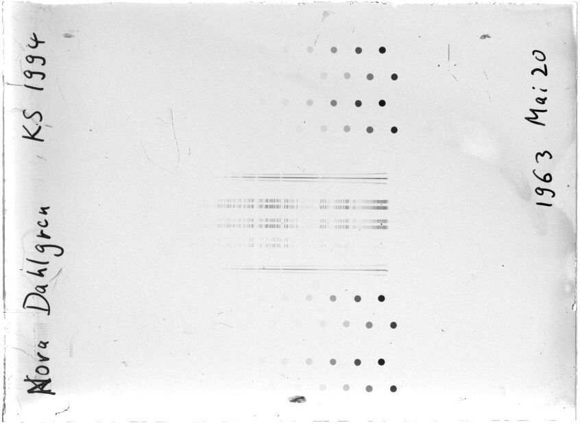 Scan STK1994